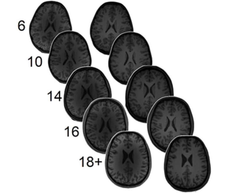 Neurotransmitter Levels Predict Math Ability 777x655 1