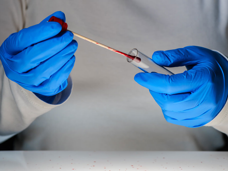 Blood Forensics Challenge Cracked Using Liquid Mechanical Principles