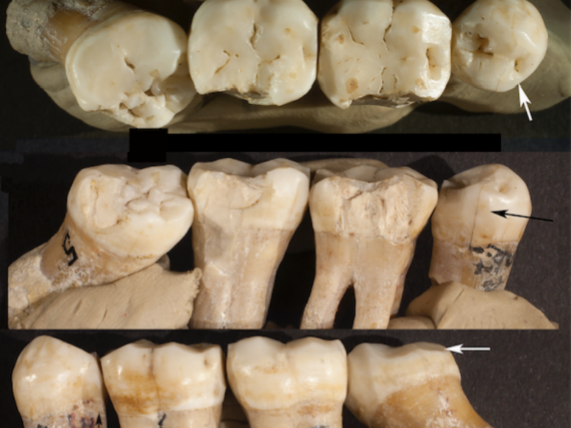 Pre Historic Teeth 800x600 1