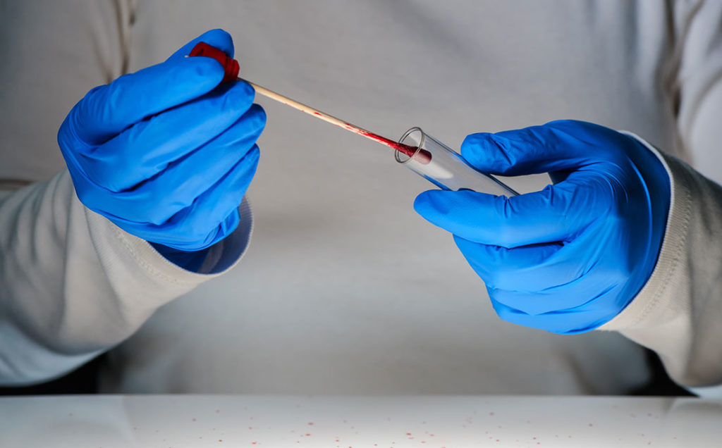 Dna Analysis 1 1024x636