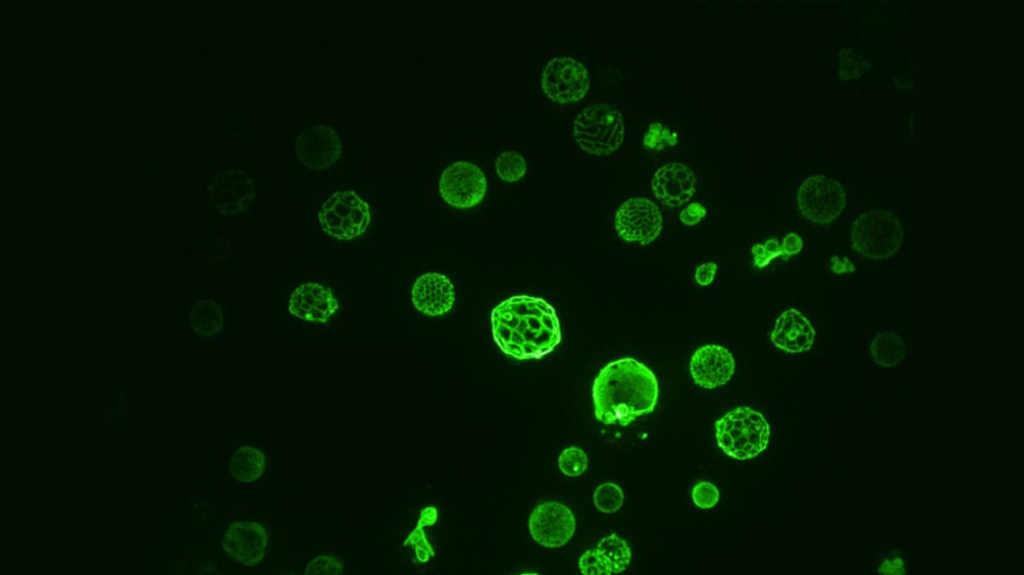 This fluorescence microscopy image shows green yeast vacuoles that have undergone phase separation floating in a black background