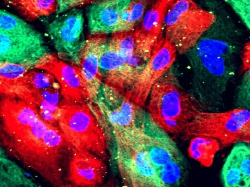 Prostate Cancer 800x600 1