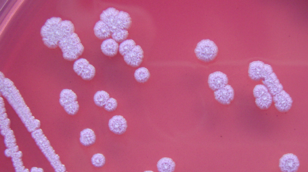 Times 5 magnification of bacteria colonies of Burkholderia pseudomallei on Ashdown