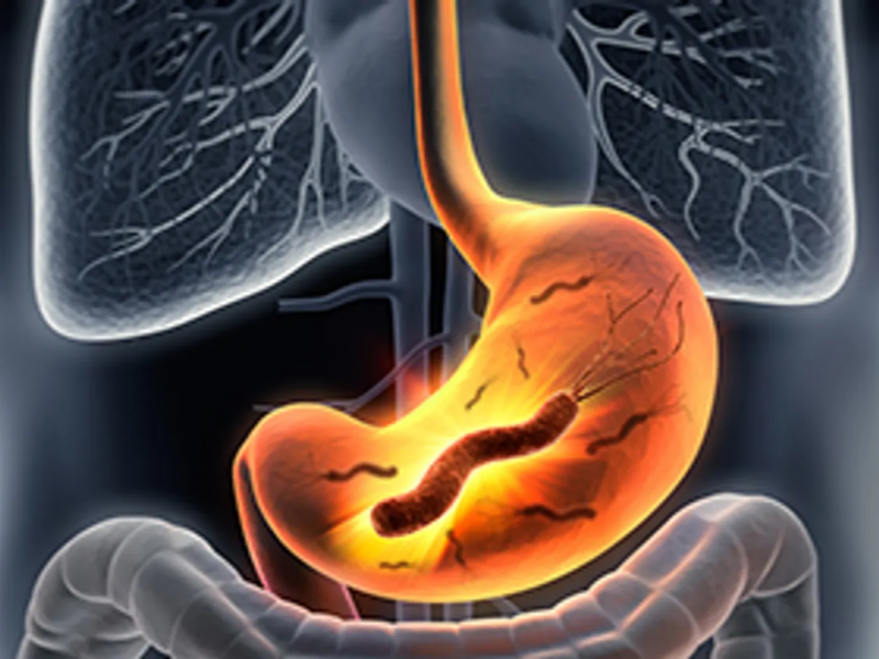 Wave Energy Can Provide Utility Scale Power Production And Works Very Well ... Of Ocean And Sea Waves And Use It To Create Energy – Usually Electricity. 99