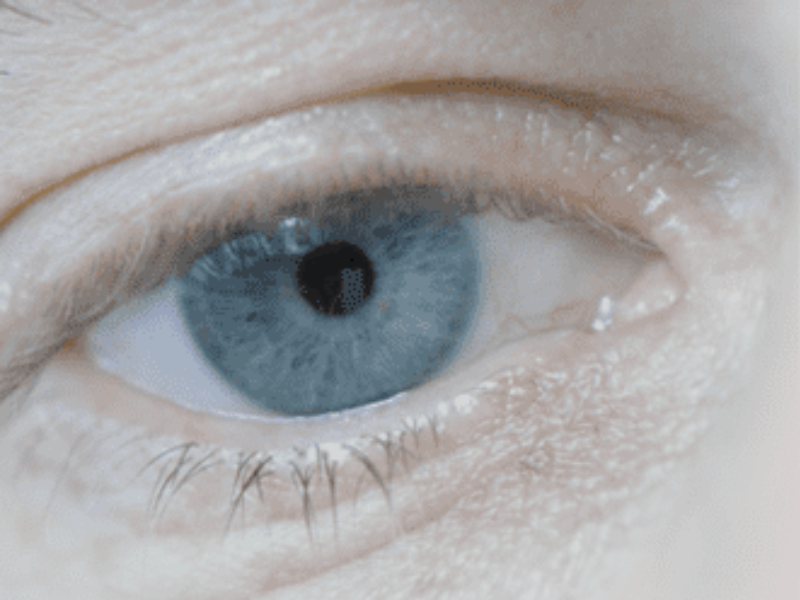 Eye Assistance 800x600 1