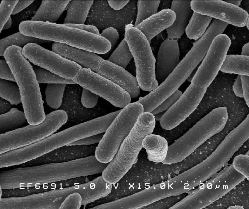Study reveals antibiotic resistance insights