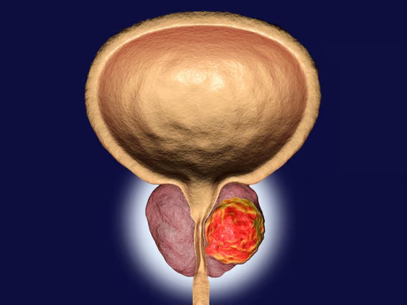 Design Sem Nome 2024 02 14T130401.255