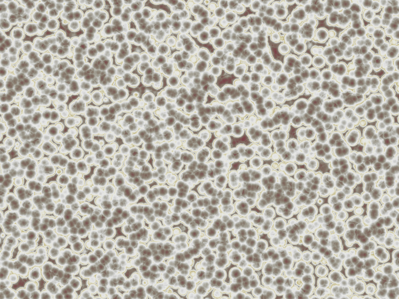 HIV is a very complicated virus, and we haven