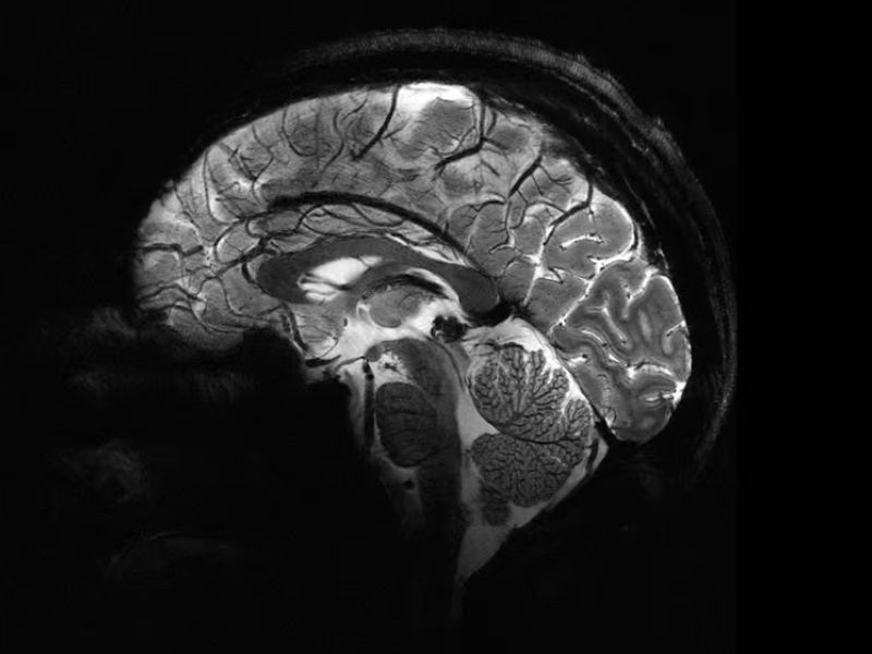 Design Sem Nome 2024 04 03T132326.255