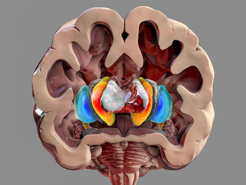Two Routes to Parkinson’s Disease May Indicate a Singular Method to Avoid Its Onset