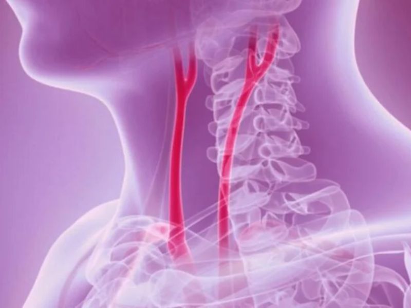 Guitar-String-Inspired Tech Enhances Blood Pressure Monitoring