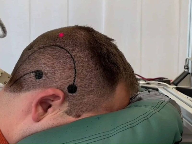 These Temporary Electronic Tattoos Can Monitor Brain Activity