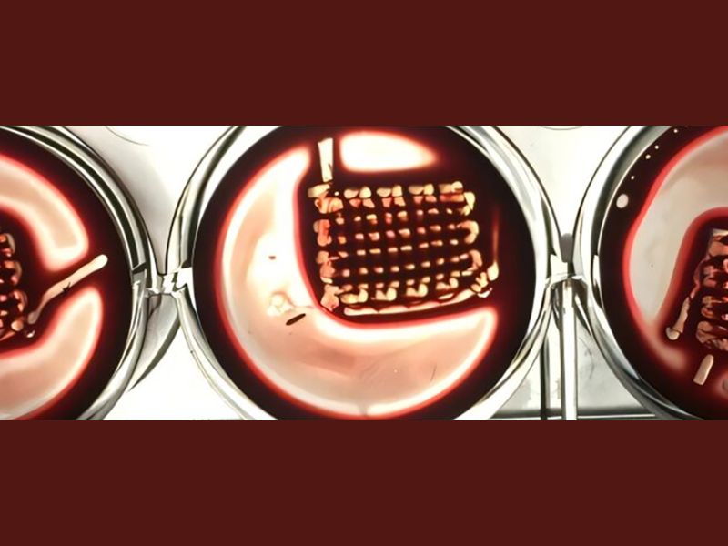 Blood-Derived Living Material Offers New Hope for Bone Repair, Study Finds