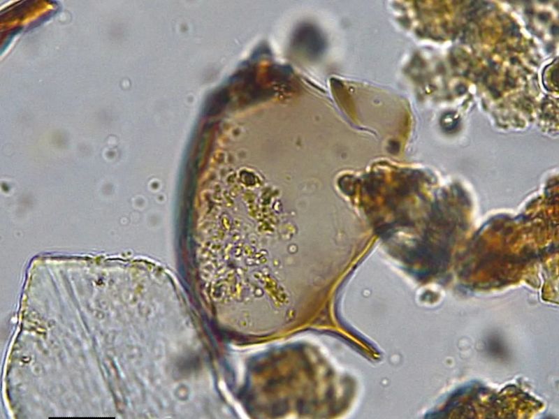 Parasites Unearthed in 500-Year-Old Toilet Expose Surprising Medieval Disease Networks