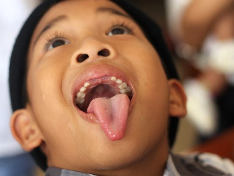 Japanese Scientists Trial Groundbreaking Medication to Regenerate Teeth