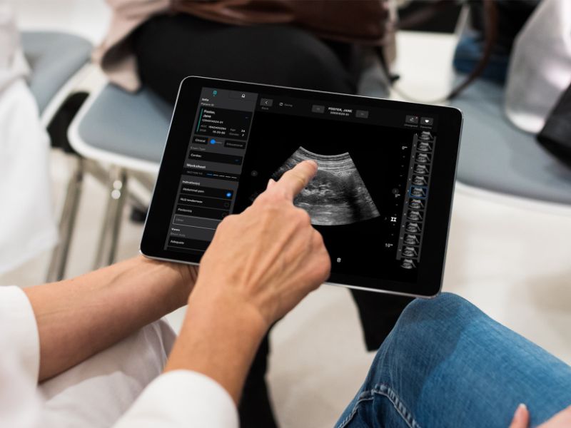 Samsung May Invest $100M in Medical Imaging Startup Exo