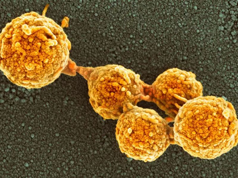 Lab-Made Artificial Life Can Grow and Divide Similarly to Natural Bacteria