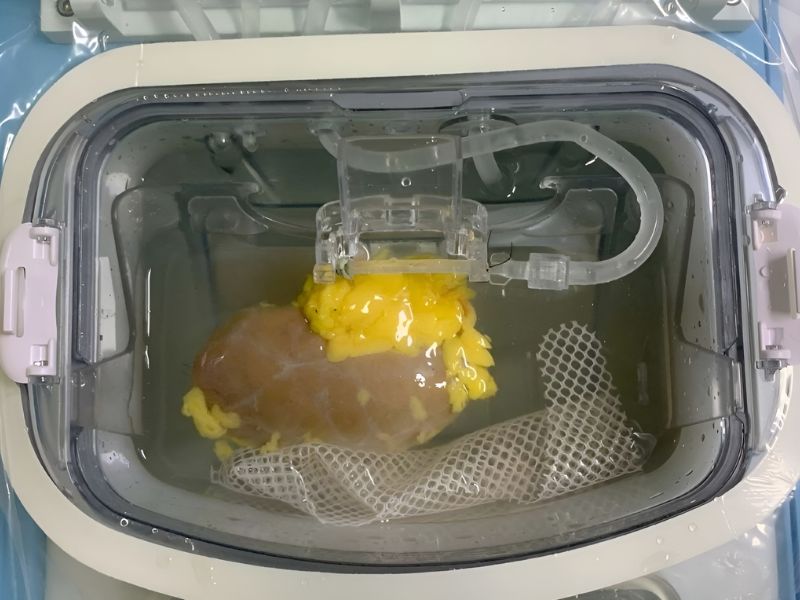 Scientists Develop a Universal Kidney Compatible With Every Blood Type