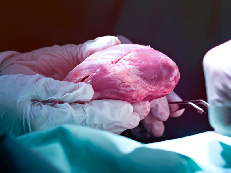 Do Organ Transplants Offer Long-Lasting Youth? A Scientific Look