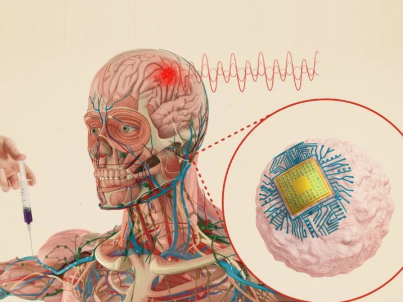 MIT’s Injectable Brain Chips May Treat Disease Without Surgery