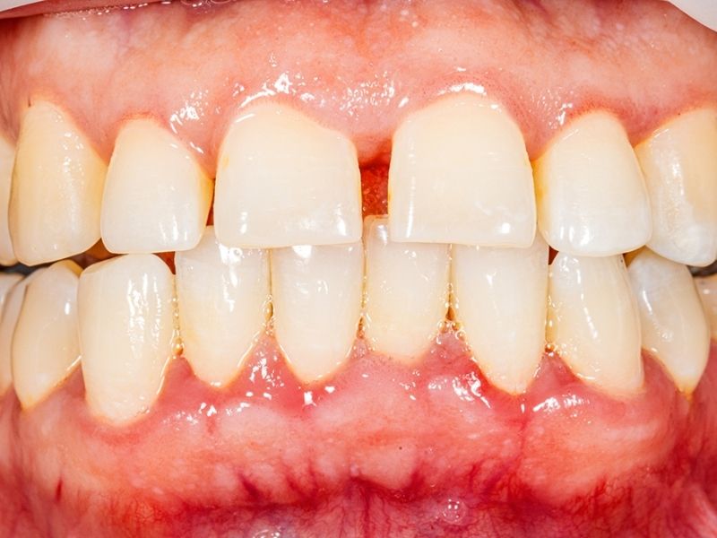 Design Sem Nome 2026 01 14T122225.952 2