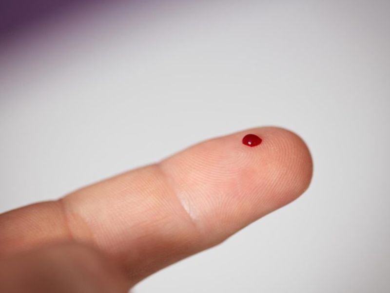 This Innovative Blood Test Can Identify Cancer Before Tumors Develop