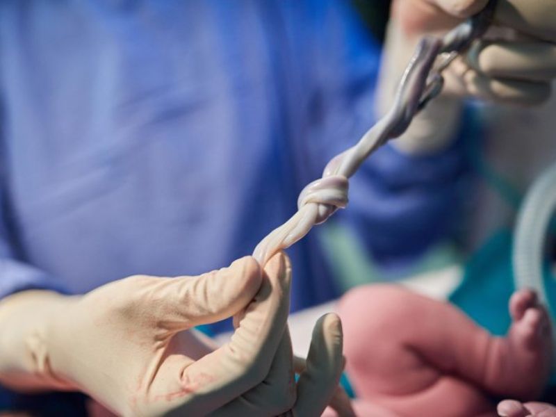 Researchers Have Uncovered a Troubling Finding in Umbilical Cord Blood