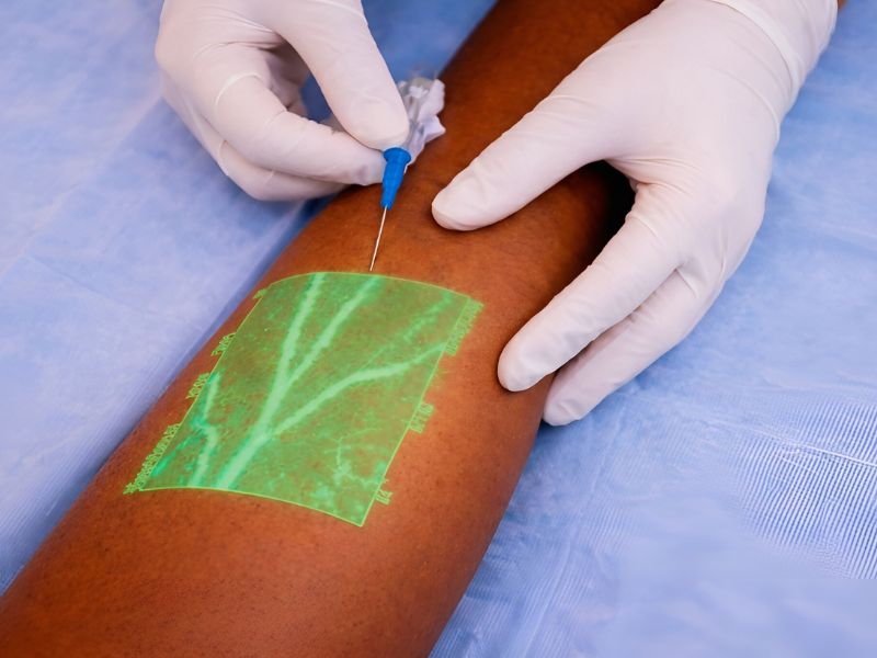 What once couldn’t be seen without special equipment can now be easily observed. A Chinese company, Vivolight, gained online attention when a demo showed its portable device projecting a real-time vein map, helping staff locate veins quickly for injections, blood draws, and IVs. Despite its almost sci-fi appearance, the goal is simple: making routine procedures faster and more accurate.
