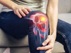 Breakthrough Drug Keeps Rheumatoid Arthritis at Bay for Years