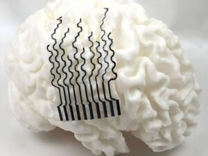 3D-printed brain sensors may enable personalized neural monitoring