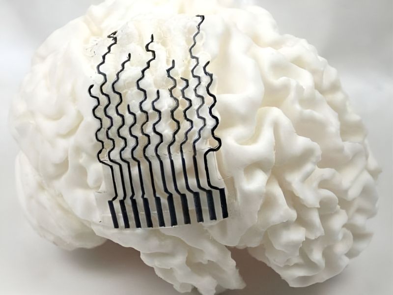 Soft, flexible electrodes tailored to the brain’s surface may improve neural monitoring and treatment of neurodegenerative diseases. Unlike rigid, one-size-fits-all sensors, the team developed a 3D-printing method to create stretchable electrodes that match each brain’s unique shape.