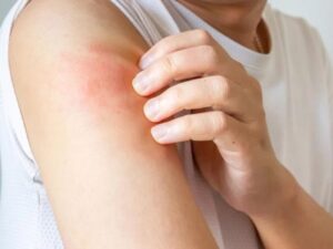 A Little-Known Hair Type Could Help Ease Chronic Itch