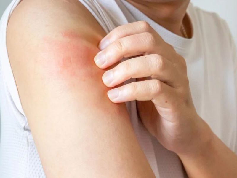 A Little-Known Hair Type Could Help Ease Chronic Itch design sem nome (17)