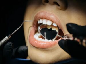 A little-known dental condition could be impacting millions of children