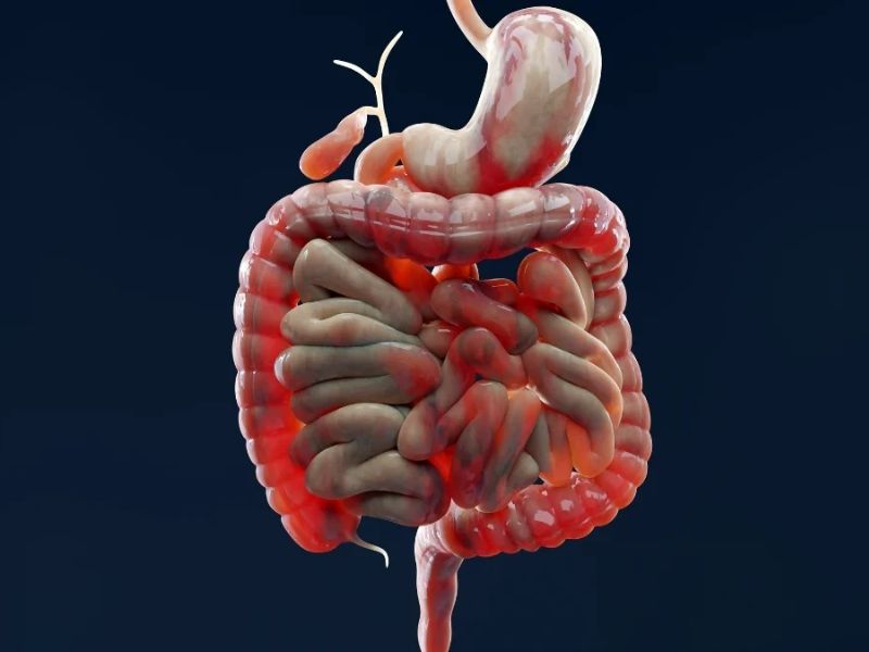 Inflammatory bowel disease (IBD) is a painful condition affecting the digestive system. Scientists have spent decades trying to understand its underlying causes in order to improve treatments for these chronic and often debilitating disorders.