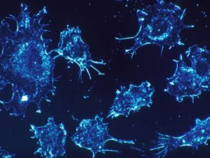 French scientists developed an antibody that beats chemo resistance in pancreatic cancer