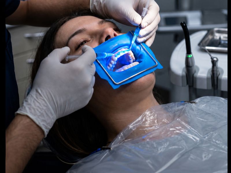 New gel developed by scientist regenerates tooth enamel design sem nome (44)